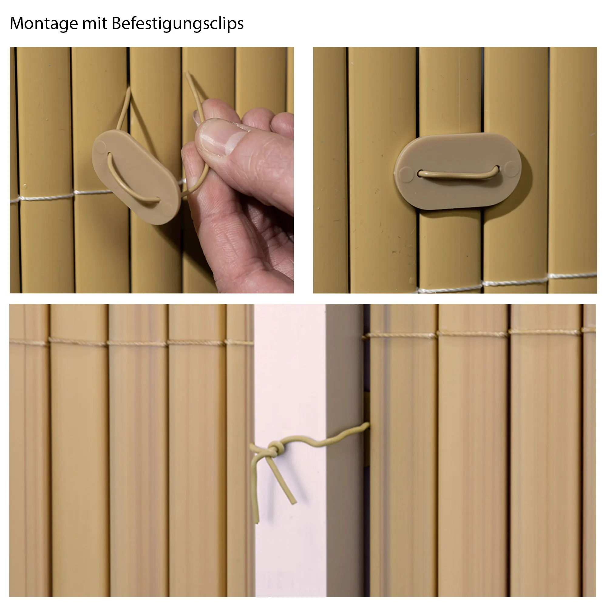 Kit di fissaggio per schermi di protezione con clip e cordini per il montaggio